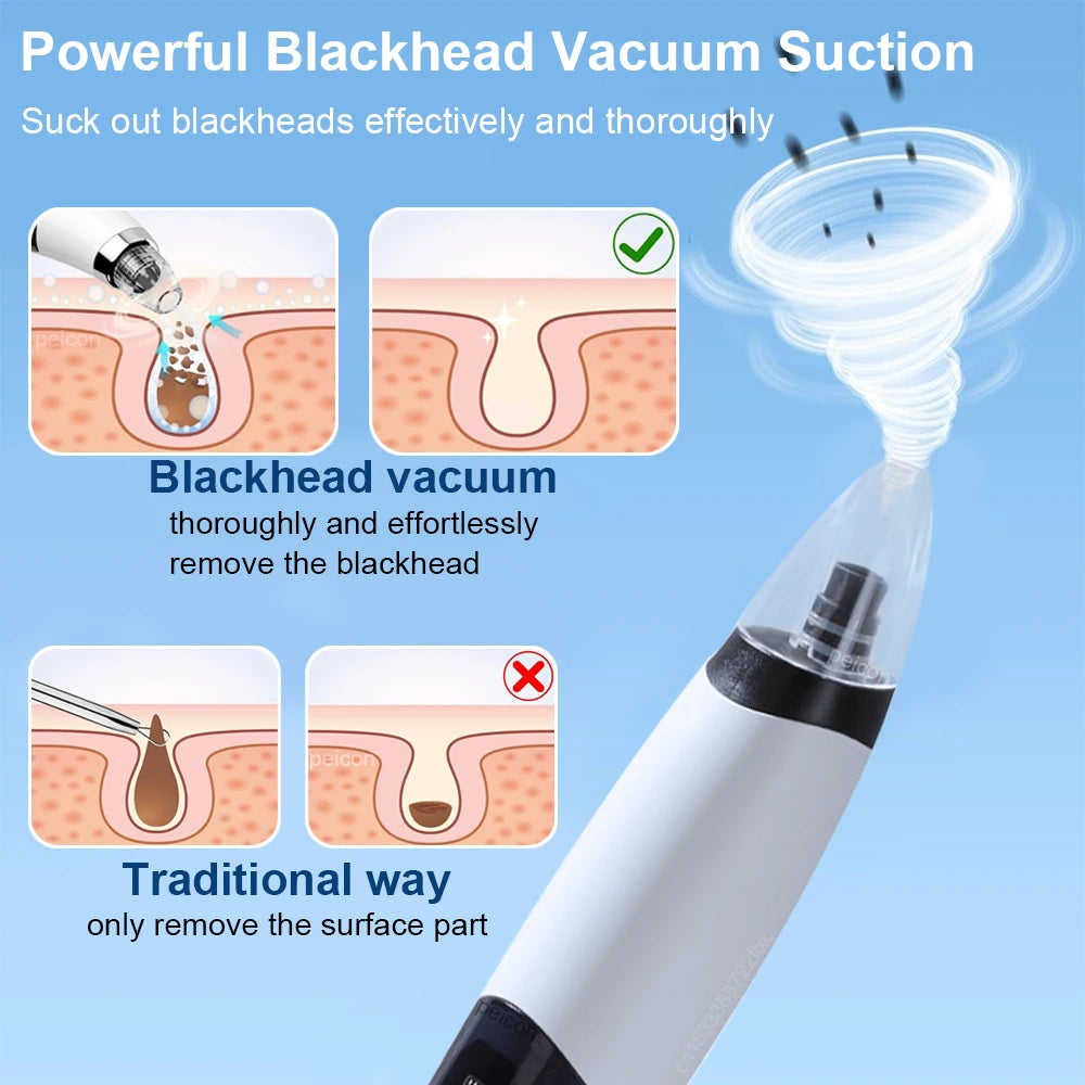 Electric Blackhead Remover Pore Vacuum – Deep Pore Cleansing & Acne Extraction Device